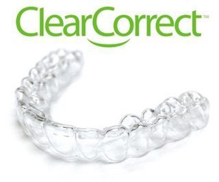 ClearCorrect aligners