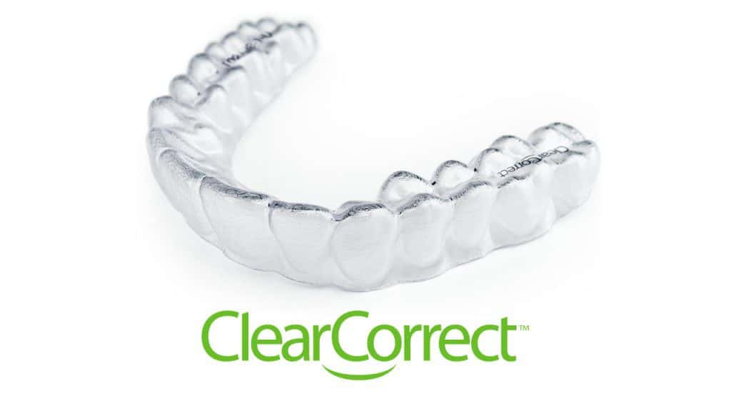 The Benefits of ClearCorrect Over Traditional Braces