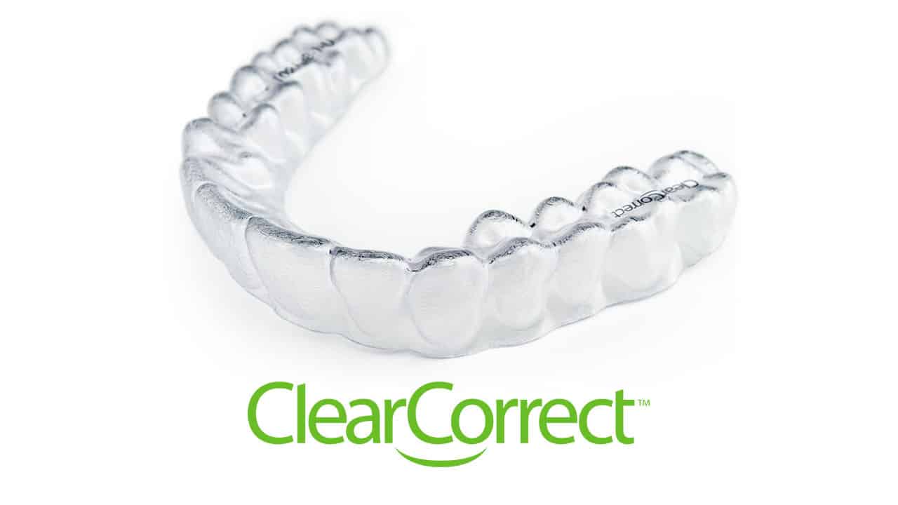 What to Ask Your General Dentist About Clear Braces for Teeth Straightening  - Media Center Dental Burbank California