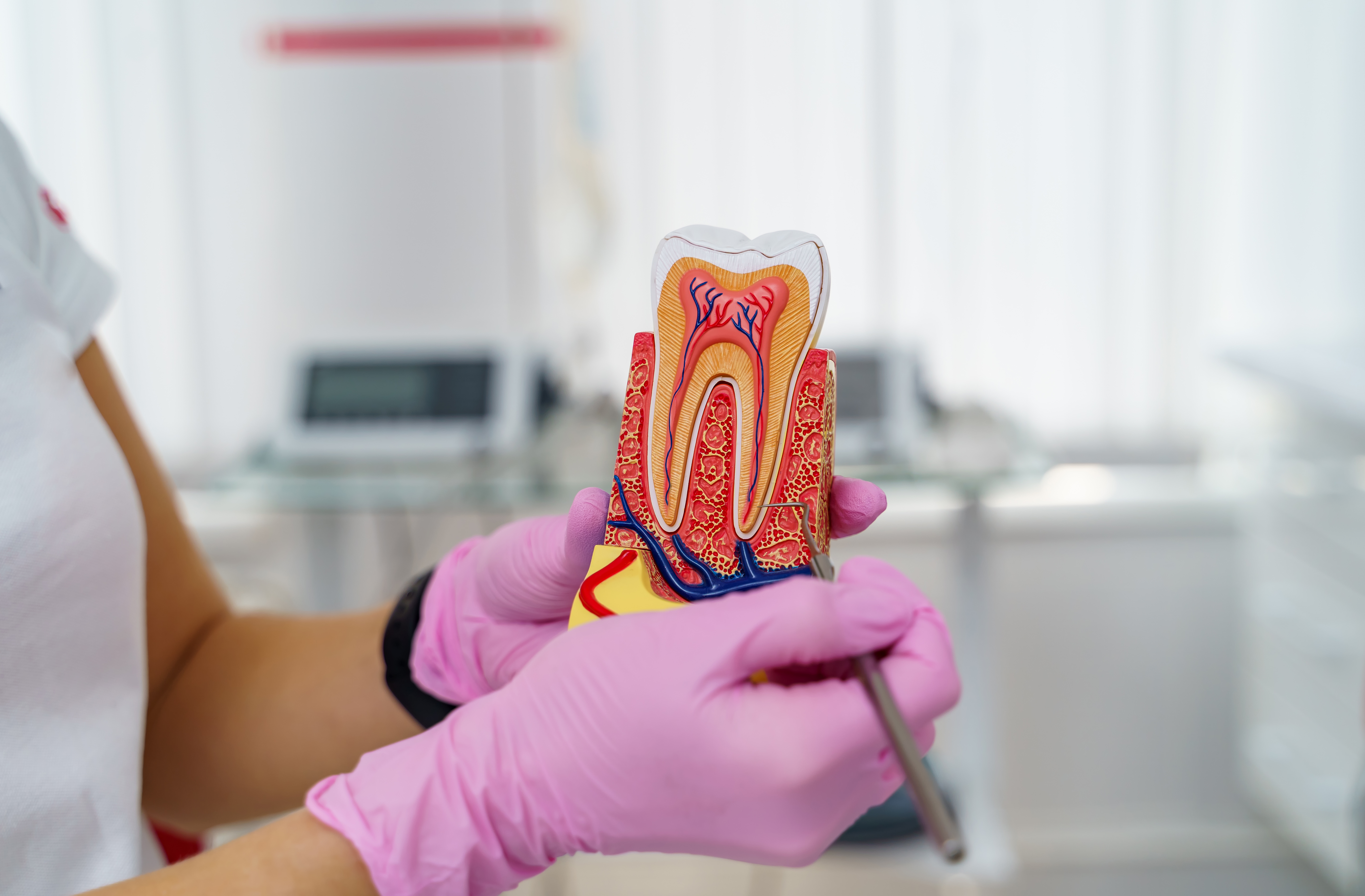 What’s The Difference Between A Root Canal And A Filling?